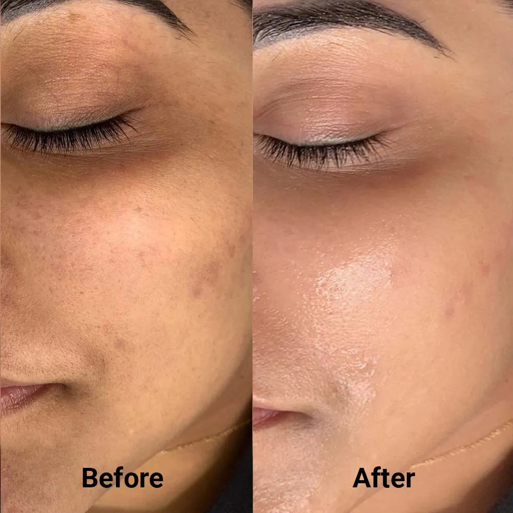 Kit Transformation LumifySkin — Masque LED + Sérum Booster