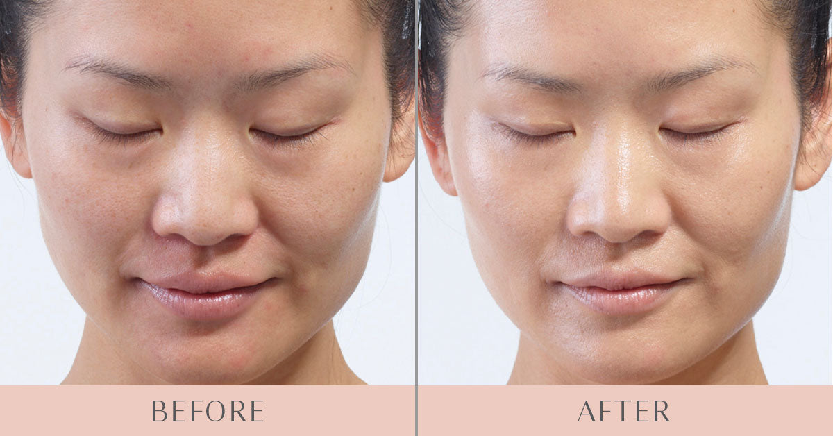Masque LED Visage LumifySkin - Thérapie Lumière Rouge Anti-Âge